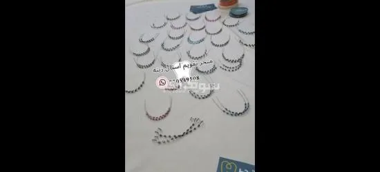 تقويم اسنان زينه( ثابت ومتحرك)🦷 - 2